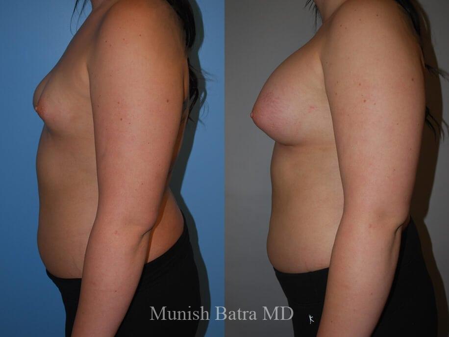 Before and After Image