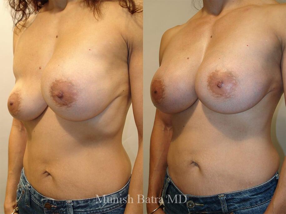 Before and After Image