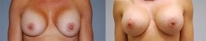 Before and After Image