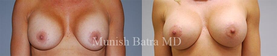 Before and After Image