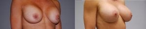 Before and After Image