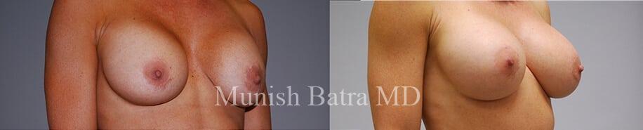 Before and After Image