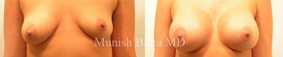 Before and After Image