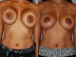 Before and After Image