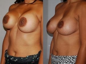 Before and After Image