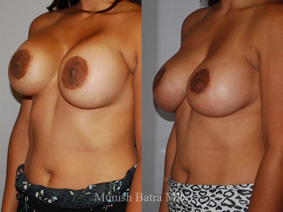 Before and After Image