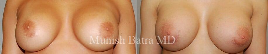 Before and After Image