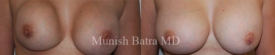 Before and After Image