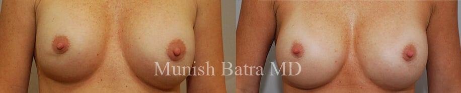Before and After Image