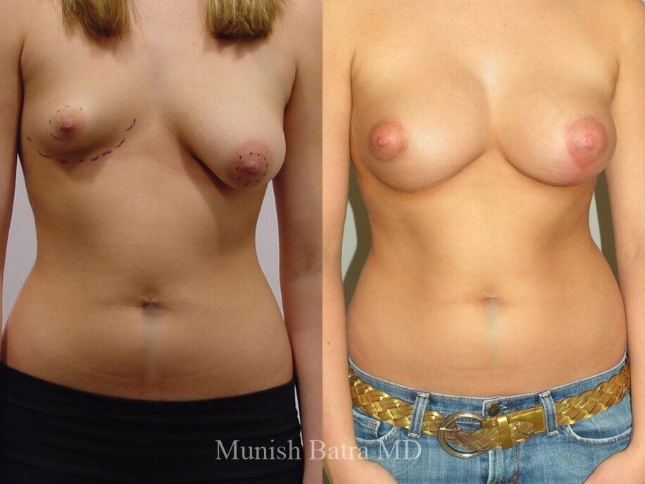 Before and After Image
