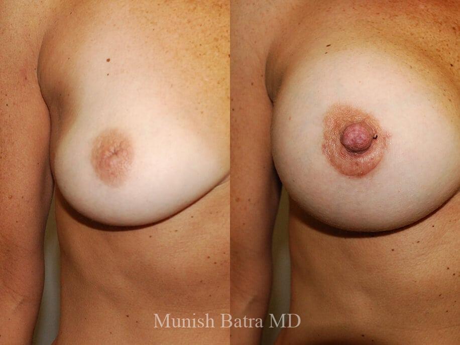 Before and After Image