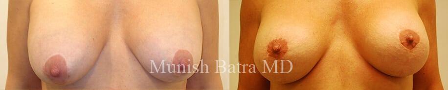 Before and After Image