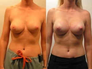 Before and After Image
