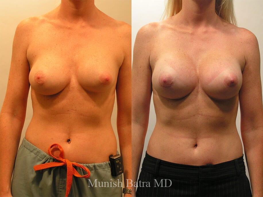 Before and After Image