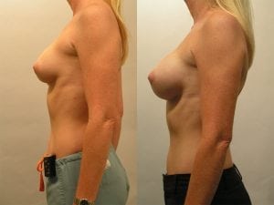 Before and After Image