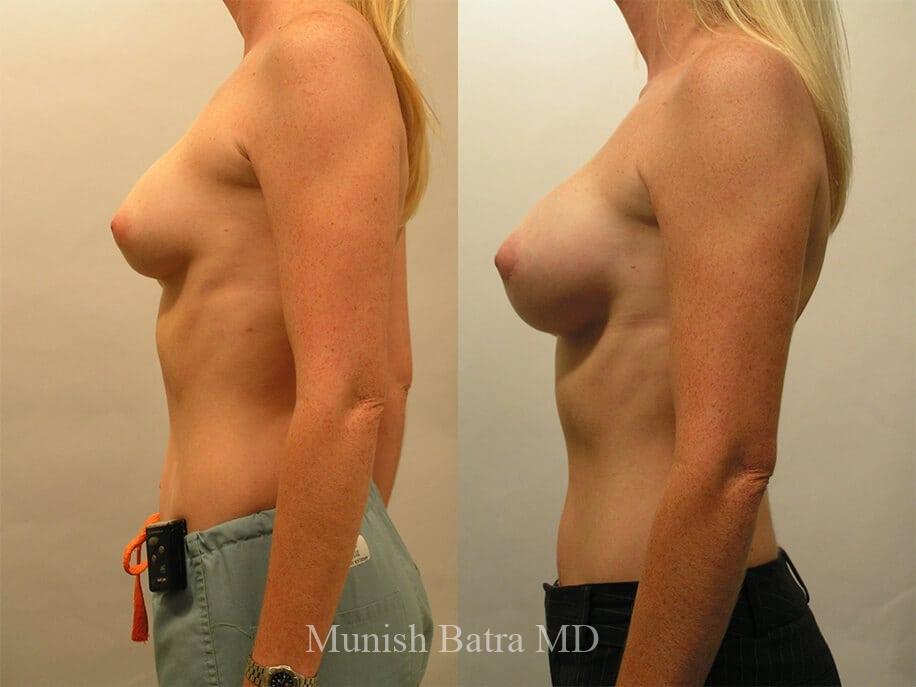 Before and After Image