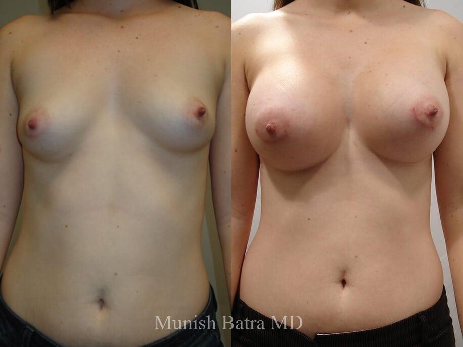 Before and After Image