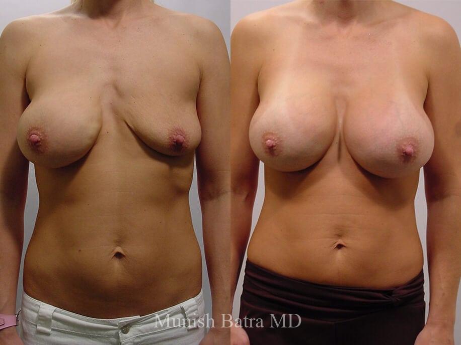 Before and After Image