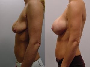 Before and After Image