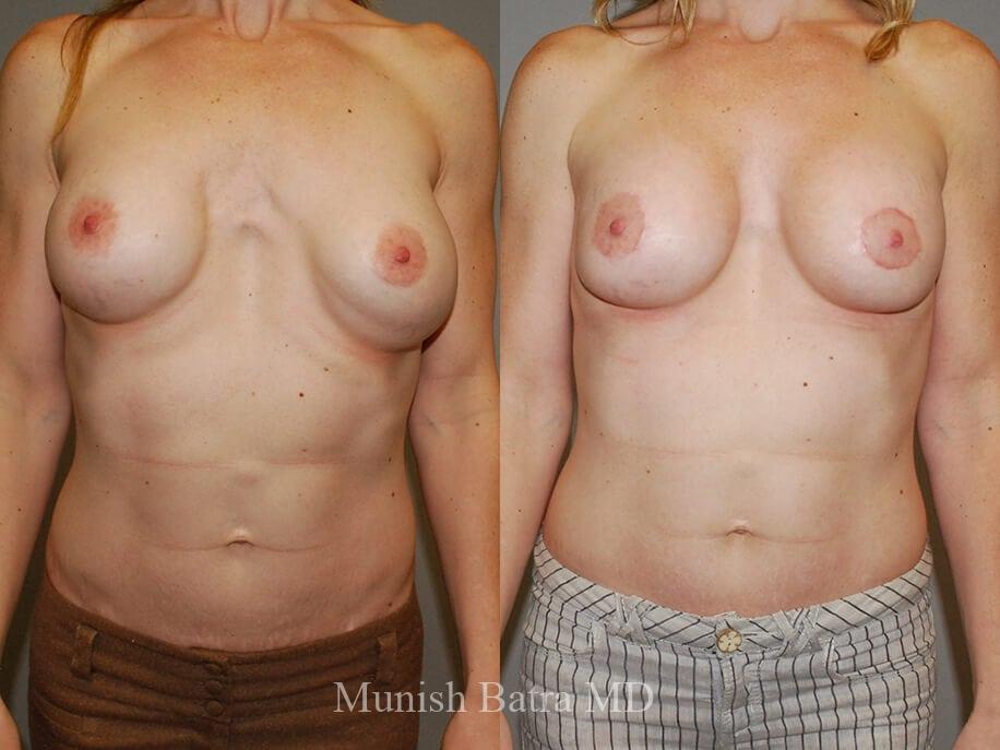 Before and After Image