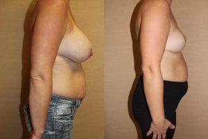 Before and After Image