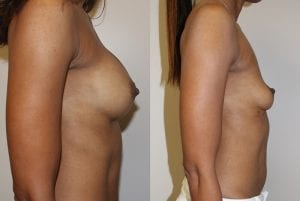 Before and After Image