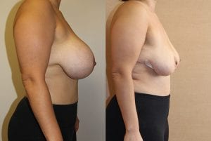 Before and After Image