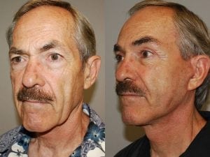 Before and After Image