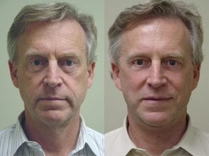 Before and After Image