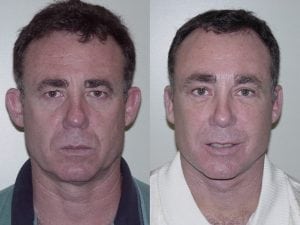 Before and After Image
