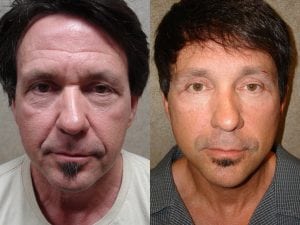 Before and After Image