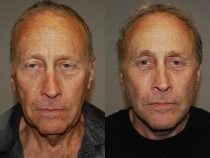 Before and After Image