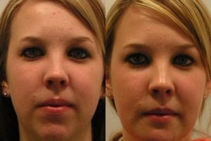 Before and After Image