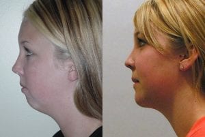 Before and After Image