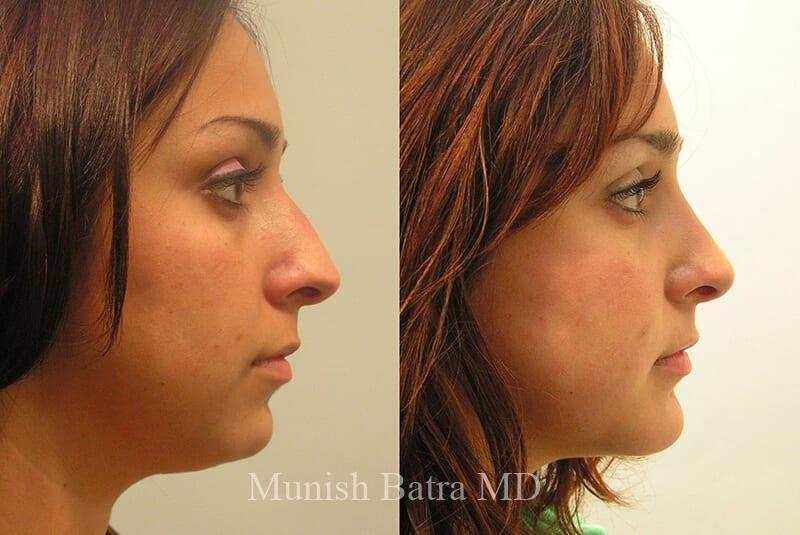 Before and After Image