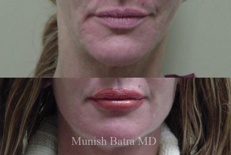 Before and After Image