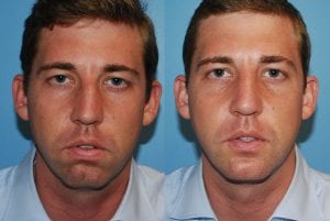 Before and After Image