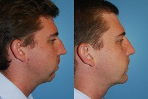Before and After Image