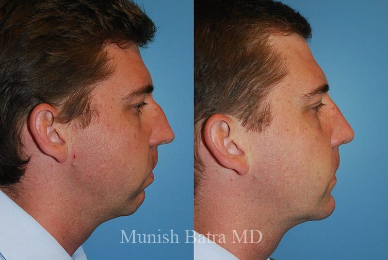 Before and After Image