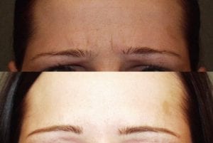 Before and After Image