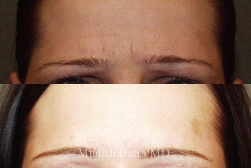 Before and After Image