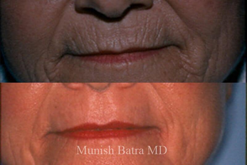 Before and After Image