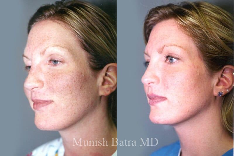 Before and After Image