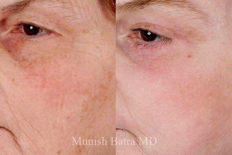Before and After Image