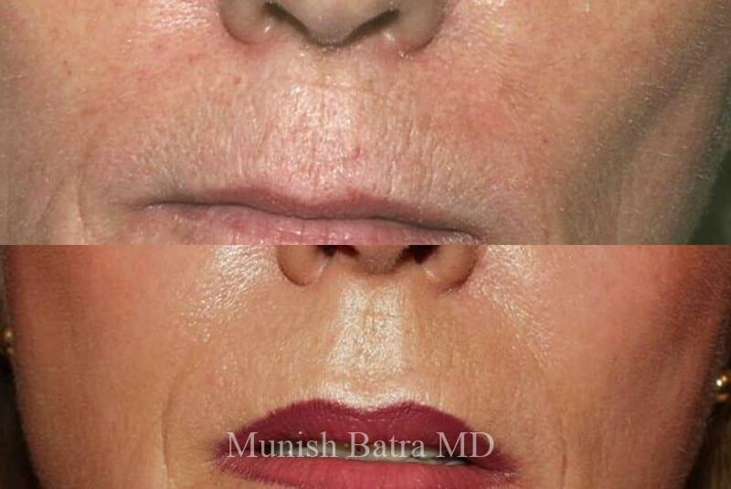 Before and After Image
