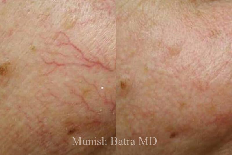 Before and After Image