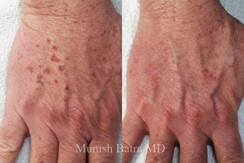 Before and After Image