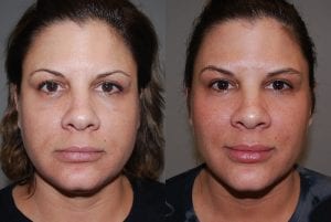 Before and After Image
