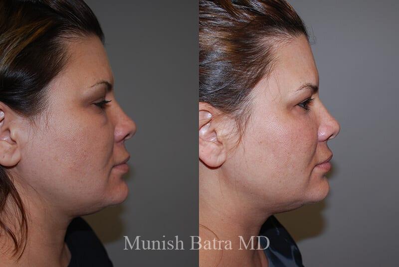 Before and After Image
