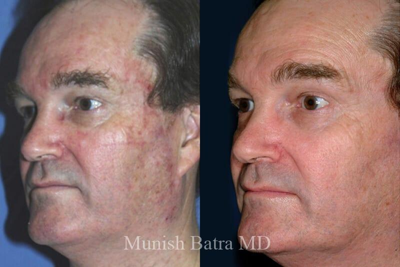 Before and After Image